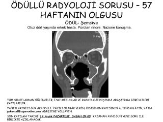 ÖDÜLLÜ RADYOLOJİ SORUSU – 57 HAFTANIN OLGUSU ÖDÜL: Şemsiye