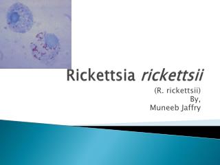 Rickettsia rickettsii