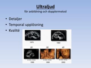 Ultraljud för avbildning och dopplermetod