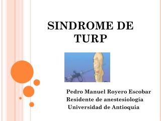 SINDROME DE TURP