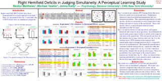 Right Hemifield Deficits in Judging Simultaneity: A Perceptual Learning Study