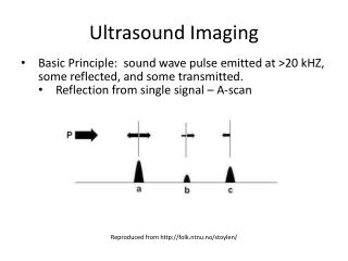 Ultrasound Imaging