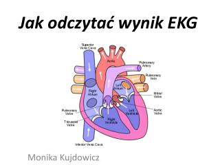 Jak odczytać wynik EKG