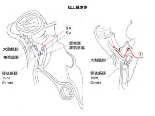 膵被膜 膵前筋膜