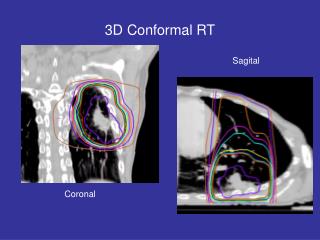 3D Conformal RT