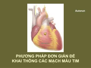 PHƯƠNG PHÁP ĐƠN GIẢN ĐỂ KHAI THÔNG CÁC MẠCH MÁU TIM