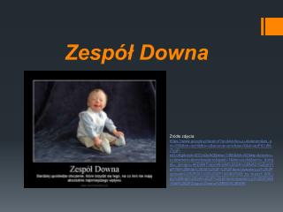 Zespół Downa