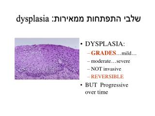 שלבי התפתחות ממאירות: dysplasia