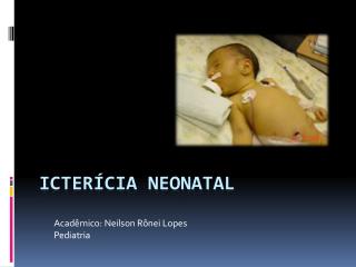 Icterícia Neonatal