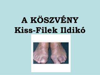 A KÖSZVÉNY Kiss-Filek Ildikó