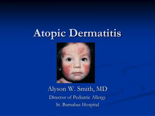 Atopic Dermatitis