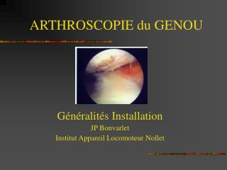 ARTHROSCOPIE du GENOU