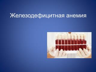 Железодефицитная анемия