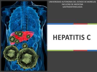 HEPATITIS C