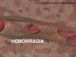 HEMORRAGIA