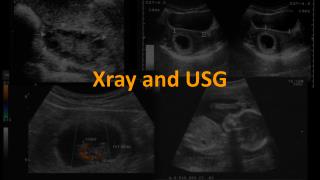 Xray and USG