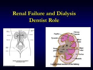 Renal Failure and Dialysis Dentist Role