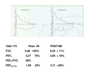 Talla 174 Peso 94 POST-BD