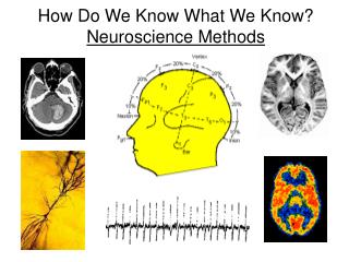 How Do We Know What We Know? Neuroscience Methods
