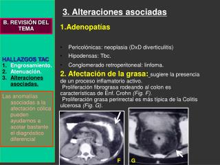 HALLAZGOS TAC Engrosamiento. Atenuación. Alteraciones asociadas.