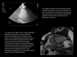 ACCPR_case1