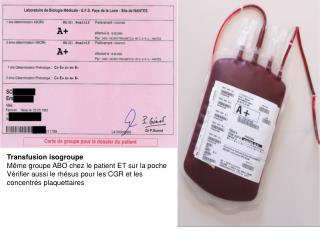 Transfusion isogroupe Même groupe ABO chez le patient ET sur la poche