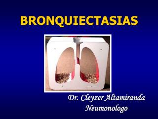 BRONQUIECTASIAS