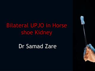 Bilateral UPJO in Horse shoe Kidney Dr Samad Zare