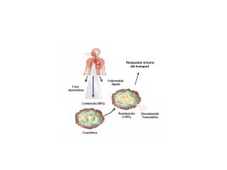 Respuesta inmune del huésped