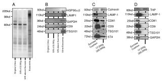 Original Urine S/N of 2,000g S/N above Sucrose Exosomes