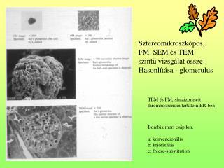 Sztereomikroszkópos, FM, SEM és TEM szintű vizsgálat össze- Hasonlítása - glomerulus