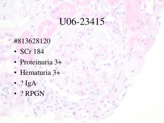 U06- 23415