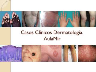 Casos Clínicos Dermatología. AulaMir