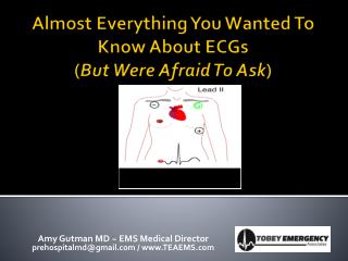 Almost Everything You Wanted To Know About ECGs ( But Were Afraid To Ask )