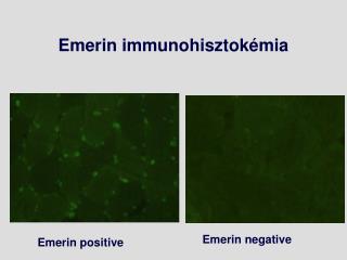 Emerin immunohisztokémia