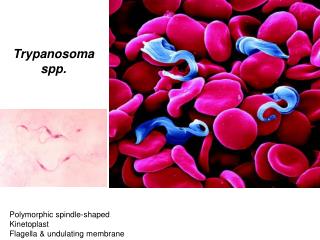 Polymorphic spindle-shaped Kinetoplast Flagella &amp; undulating membrane