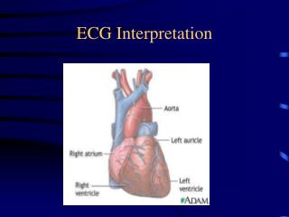 ECG Interpretation