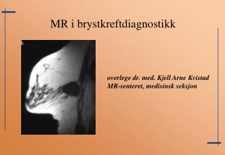 overlege dr. med. Kjell Arne Kvistad MR-senteret, medisinsk seksjon