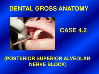 DENTAL GROSS ANATOMY CASE 4.2 (POSTERIOR SUPERIOR ALVEOLAR