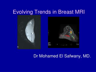 Evolving Trends in Breast MRI