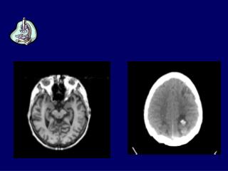 Tecniche di indagine morfologica: MRI TC