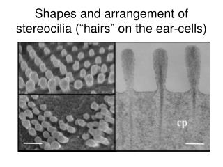 Shapes and arrangement of stereocilia (“hairs” on the ear-cells)