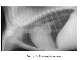 Caniche 16a: Ectasie oreillette gauche