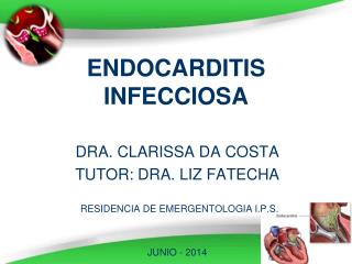 ENDOCARDITIS INFECCIOSA