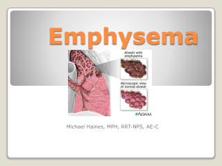 Emphysema