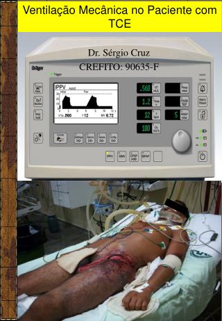 Ventilação Mecânica no Paciente com TCE