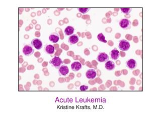 Acute Leukemia