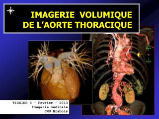 IMAGERIE VOLUMIQUE DE L’AORTE THORACIQUE