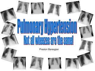 Pulmonary Hypertension