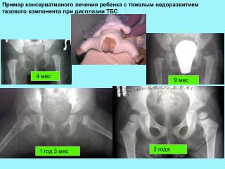 4 мес